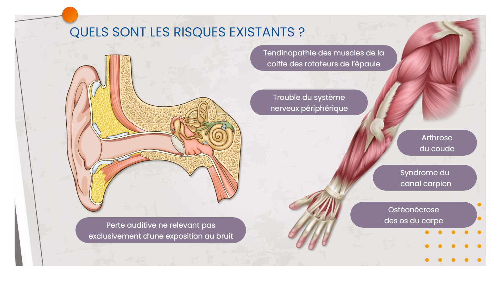 2.	Les vibrations transmises aux membres supérieurs